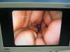 PENTAX EC-380FKp Colonoscope