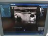 MINDRAY 7L4P Ultrasound Transducer