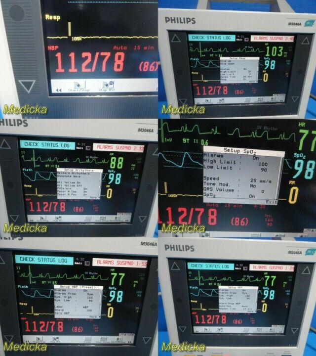 PHILIPS 2004 M3046A M3 , W/ M3000A MMS Module & Leads ~ Patient Monitor