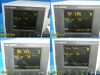 GE/COROMETRICS 120 Series Maternal Fetal Monitor