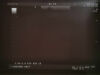 ALOKA UST-5045 P Biopsy Linear Probe Ultrasound Transducer