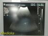 ATL C7-4 40R Ref 4000-0301-03 Curved Array Ultrasound Transducer