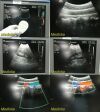 ATL C7-4 40R Ref 4000-0301-03 Curved Array Ultrasound Transducer
