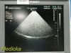 ATL P3-2 20mm Ref D4000-0287-04 Phased Array Ultrasound Transducer