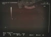 HITACHI C314T Ultrasound Transducer