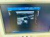 PHILIPS IU22 cart G.1 Ultrasound - Cardiac - Vascular