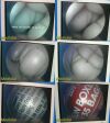 SMITH & NEPHEW Arthroscopy Sys W/ 460P Camera W/ Multimode Camera & Scope