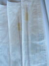 TELEFLEX MEDICAL Qty. of 5 Teleflex Ref: 570722 Cat. #662530 2 Way Foley Couvelaire Tip Catheter 22Ch. O.D. 7.3mm / 30ml Exp. 01/2020