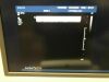 PHILIPS L17-5 Ultrasound Transducer