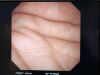 OLYMPUS GIF-XP260NS Gastroscope
