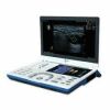 EZONO 5000 Ultrasound