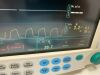 DATEX-OHMEDA FM patient monitor with CO2 module Monitor