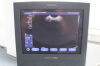 SIEMENS Acuson X150 Machine