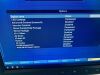 GE Vivid E9 BT13 soft ver 113 XDclear YOM 2015 Ultrasound - Cardiac - Vascular