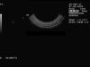 SIEMENS/ACUSON EVC8 Ultrasound Transducer