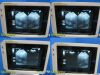 GE 2005  MTZ 6.5 Mhz P9603MB Endocavity Ultrasound Transducer