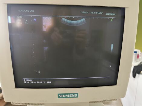 DIAGNOSTIC ULTRASOUND Siemens Sonoline G50 Ultrasound System