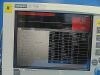 SIEMENS 2005  SC 7000, W/ Infinity Docking Station & Power Supply ~ Monitor