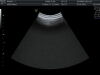 GE RAB6-D Ultrasound Transducer