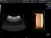GE RAB6-D Ultrasound Transducer