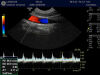 GE 10C-D Ultrasound Transducer