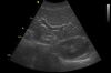 GE 3C-RS Ultrasound Transducer