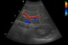 GE 3C-RS Ultrasound Transducer