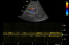 GE 3C-RS Ultrasound Transducer