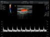 GE 9L-D Ultrasound Transducer