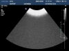 PHILIPS C5-2 Ultrasound Transducer