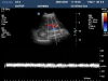 PHILIPS C5-2 Ultrasound Transducer