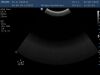 PHILIPS C6-3 Ultrasound Transducer