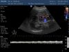 PHILIPS C6-3 Ultrasound Transducer