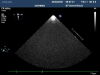 PHILIPS S7-2 Omni Ultrasound Transducer