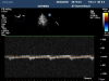 PHILIPS S7-2 Omni Ultrasound Transducer