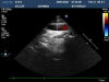 PHILIPS S12-4 Ultrasound Transducer