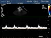 PHILIPS S12-4 Ultrasound Transducer