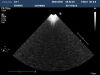 PHILIPS X3-1 Ultrasound Transducer
