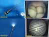 SMITH & NEPHEW DYONICS Multimode Video Rigid Telescope 30Â° x 4mm (TESTED)