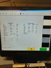 LUNAR Prodigy Bone Densitometer