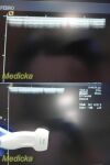 ACUSON 15L8 ERGO Linear Array Ultrasound Transducer