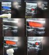 ACUSON 15L8 ERGO Linear Array Ultrasound Transducer