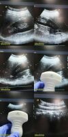 SIEMENS/ACUSON 2005 Acuson 4C1 Convex Array Ultrasound Transducer