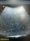 ACUSON 2003  6C2 Convex Array Ultrasound Transducer