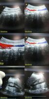 ACUSON 2003  6C2 Convex Array Ultrasound Transducer