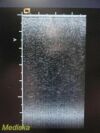 ACUSON 6L3 Ref 08252598 Linear Array Ultrasound Transducer