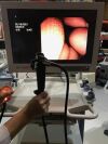 OLYMPUS JF Type 100 Duodenoscope