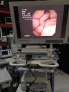 OLYMPUS CYF-V2 with OTVs7 image processor . Cystoscope