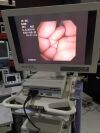OLYMPUS CYF-V2 with OTVs7 image processor . Cystoscope