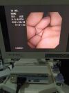 OLYMPUS CYF-V2 with OTVs7 image processor . Cystoscope